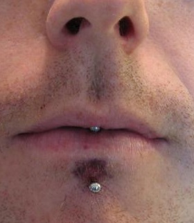 Bruised Labret Piercing Bruised Labret Piercing
