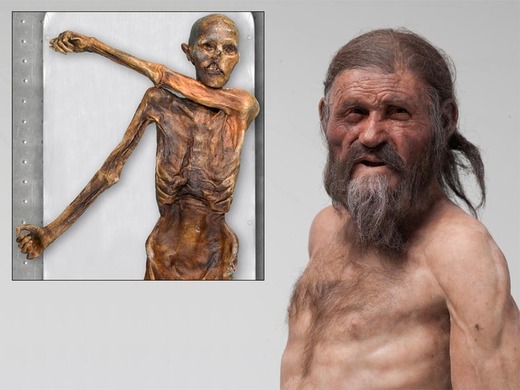 Otzi the Iceman Mummy and Projected Image of How He Looked in Life 