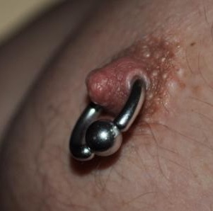 Infection, Nipple Healing, Nipple Piercing Problems
