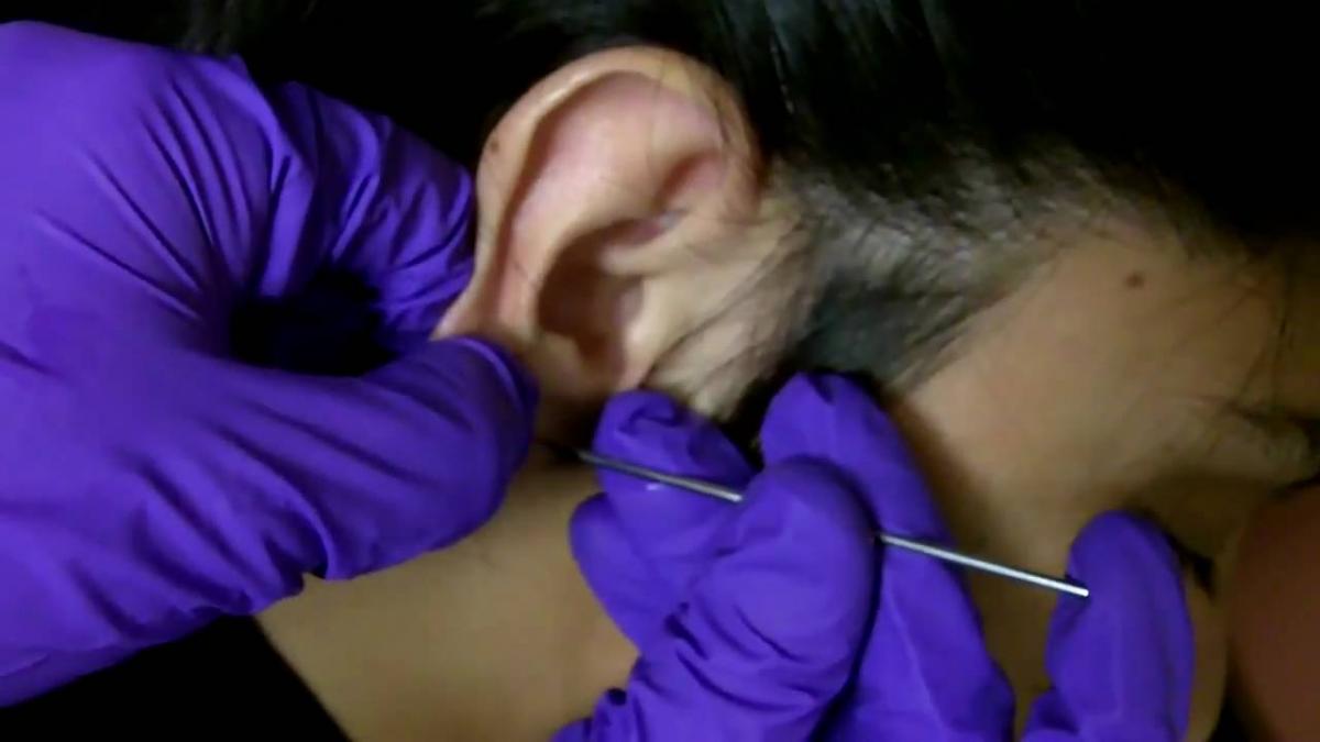 Proper Ear Piercings Should Be Performed With Needles by a Professional Piercer 