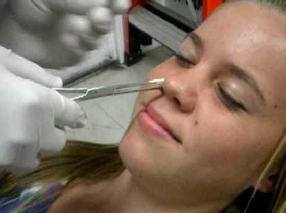Nostril Piercing in Progress Nostril Piercing in Progress