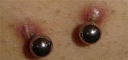 Surface Piercing Hypergranulations 