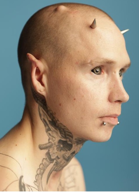 Dermal Implants by Arseniy Andersson 
