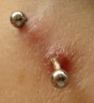 Example of Piercing Migration and Piercing Rejection 
