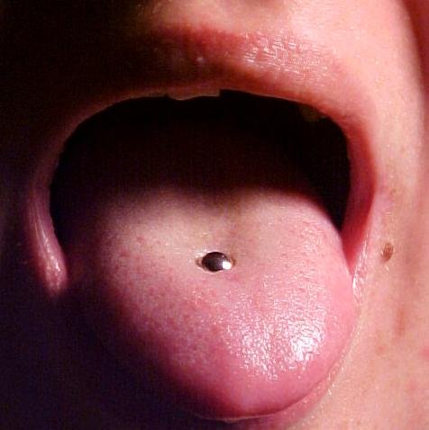 Swollen Tongue Piercing 