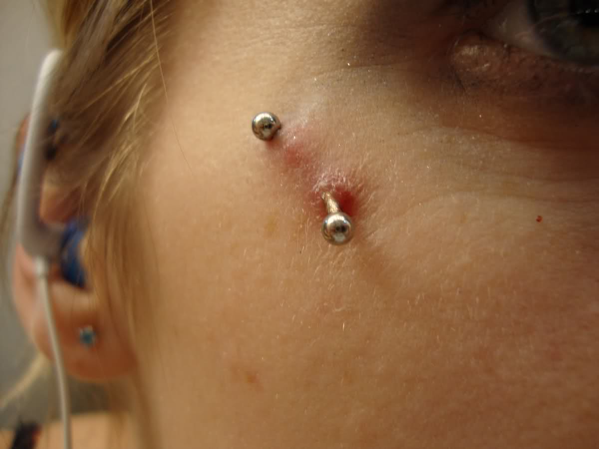 Rejecting Surface Piercing | Migration and Rejection 