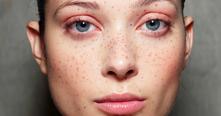 Freckle tattoo, beauty tattoo, make up tattoo