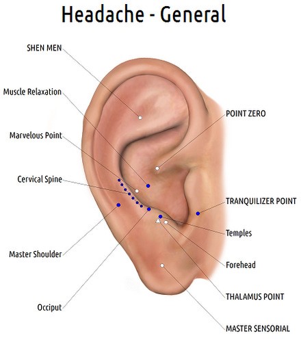 Ear Diagram, Nogier Diagram, Headache Piercing, Daith