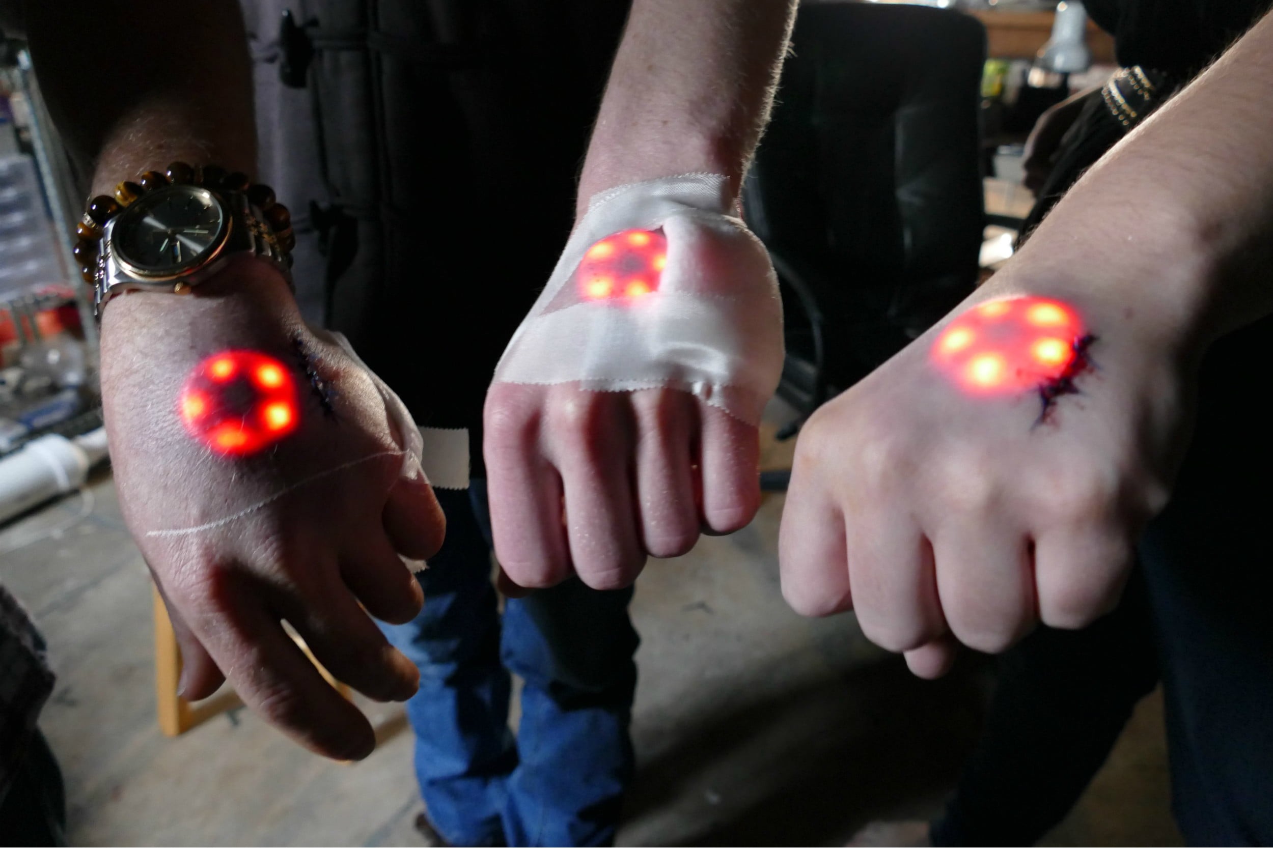 LED implant, LED hand, biohack, grinder biohack
