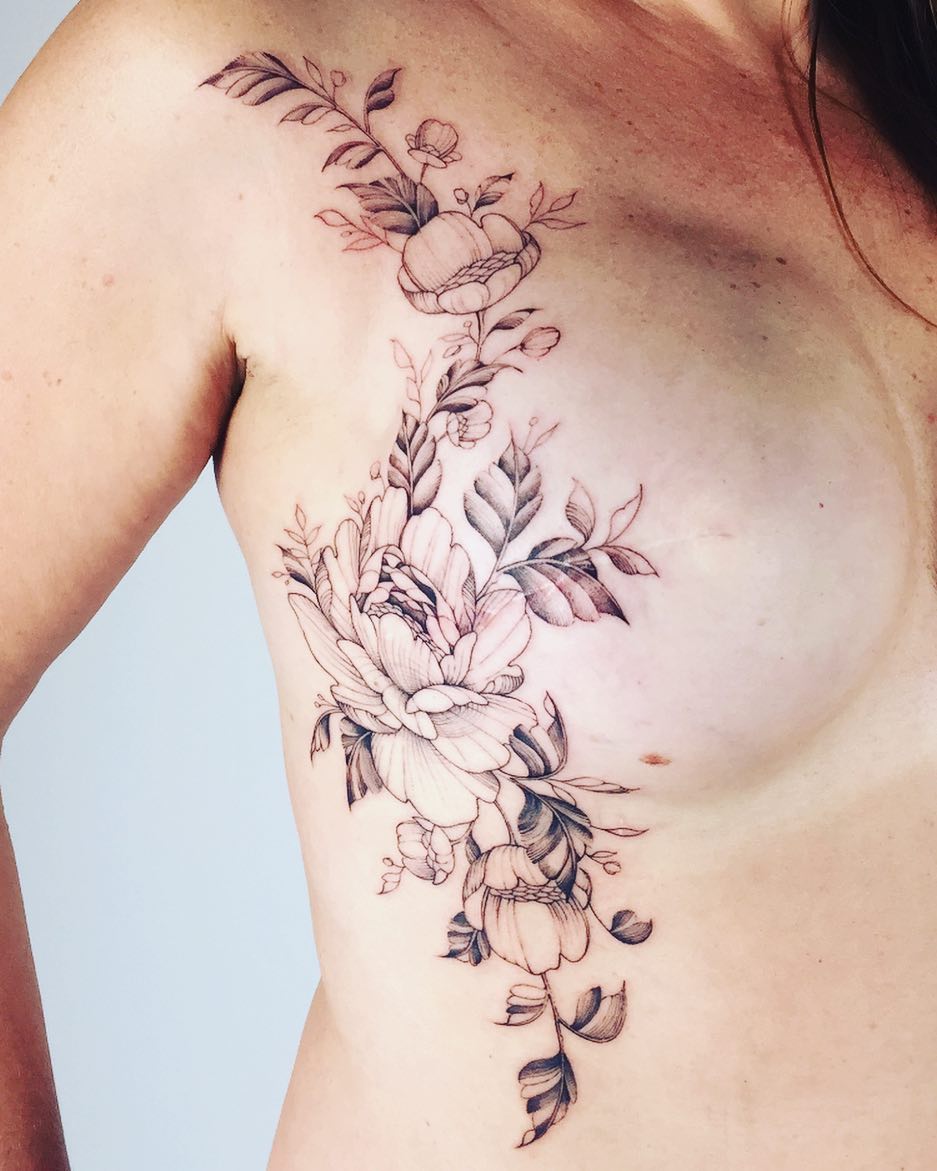 scar tattoos, cover up tattoos, scar cover up tattoos, Hannah Nova tattoo