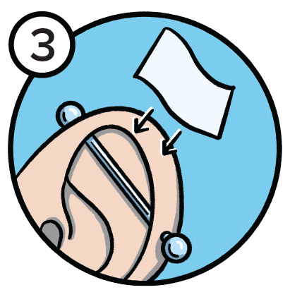 Illustration of cartilage being dried