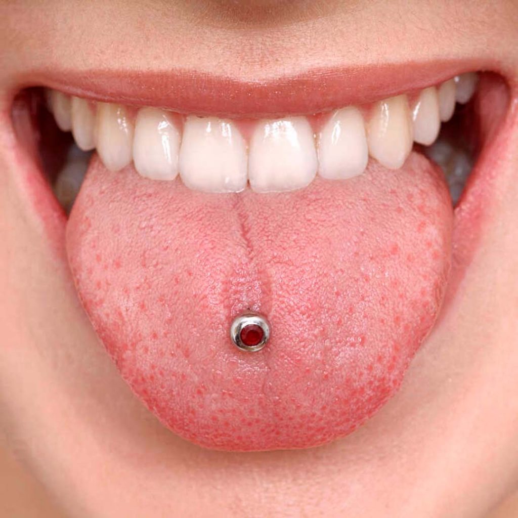 Smiling client with tongue piercing and red-jeweled accessory